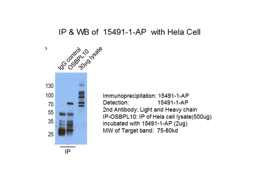 [15491-1-AP-150UL] OSBPL10 Polyclonal antibody