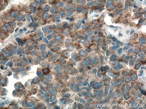 [15492-1-AP-150UL] MARK2 Polyclonal antibody
