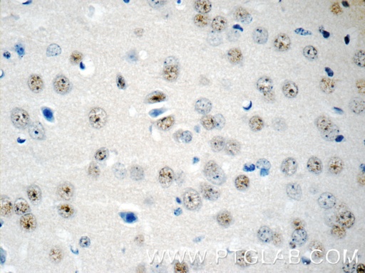 [15494-1-AP-20UL] RUNX1T1 Polyclonal antibody