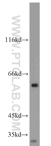 [15497-1-AP-150UL] DR5-Specific Polyclonal antibody