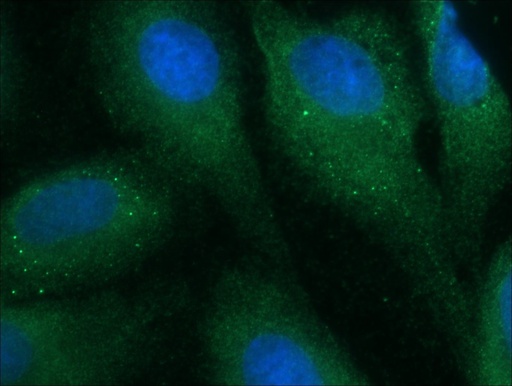 [15500-1-AP-20UL] DISC1-long-specific Polyclonal antibody