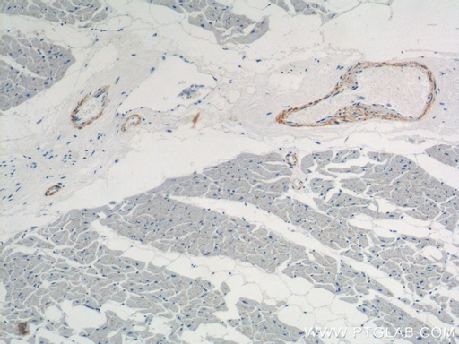 [15502-1-AP-20UL] transgelin/SM22-specific Polyclonal antibody