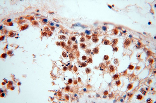 [15503-1-AP-150UL] NFKB2,p52,p100-Specific Polyclonal antibody