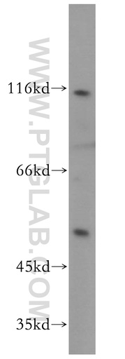 [15506-1-AP-150UL] NFKB1,p105,p50-Specific Polyclonal antibody