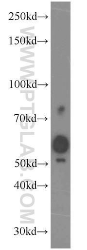 [15509-1-AP-150UL] SPO11 Polyclonal antibody