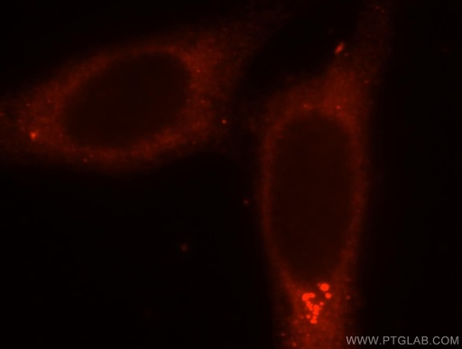 [15511-1-AP-20UL] SMU1 Polyclonal antibody