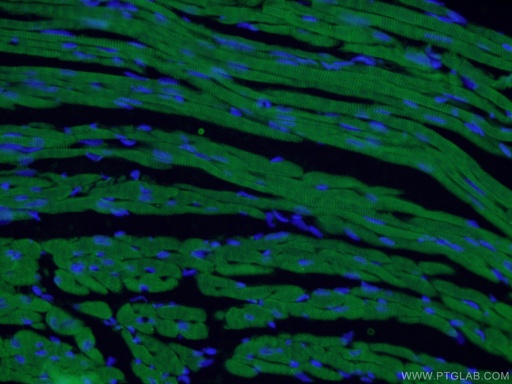 [15513-1-AP-150UL] Cardiac Troponin T Polyclonal antibody