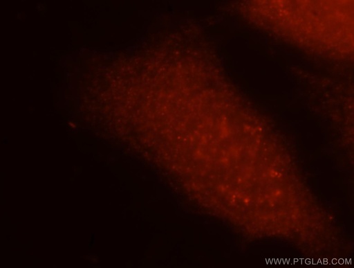 [15517-1-AP-20UL] GMPPA Polyclonal antibody