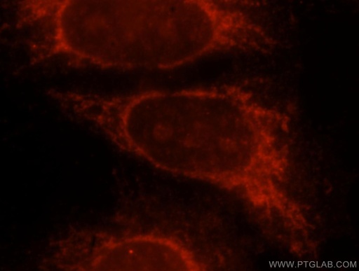 [15518-1-AP-20UL] Beta Galactosidase Polyclonal antibody