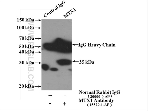 [15529-1-AP-150UL] MTX1 Polyclonal antibody