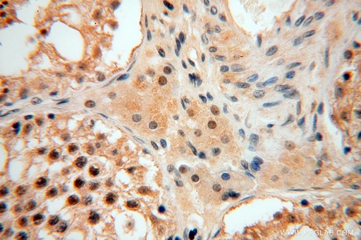 [15532-1-AP-150UL] PPM1G Polyclonal antibody