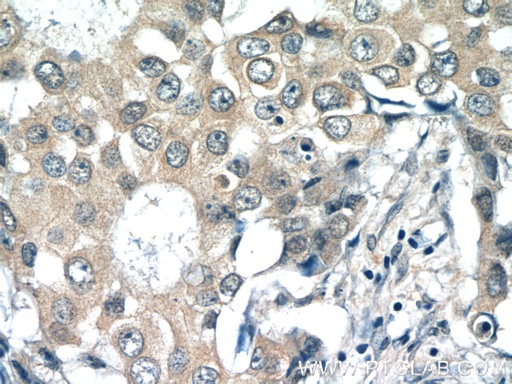 [15535-1-AP-20UL] RPL36AL Polyclonal antibody