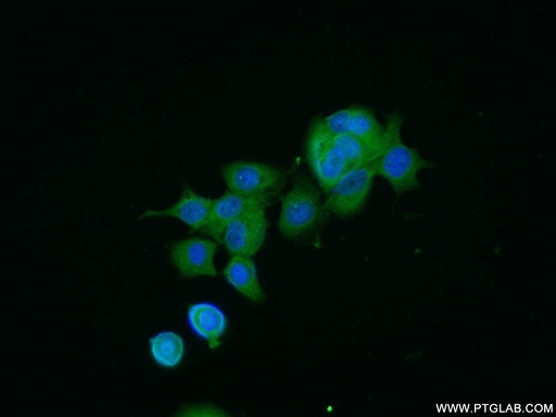 [15538-1-AP-150UL] NTF2 Polyclonal antibody