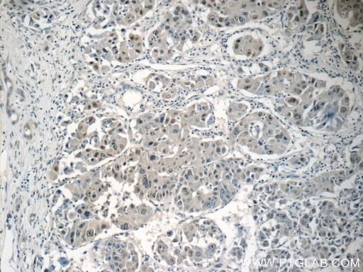 [15541-1-AP-20UL] TRPT1 Polyclonal antibody