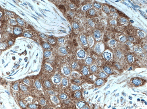 [15542-1-AP-150UL] MRPL49 Polyclonal antibody