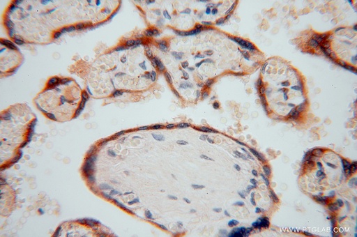 [15545-1-AP-20UL] PDIR Polyclonal antibody