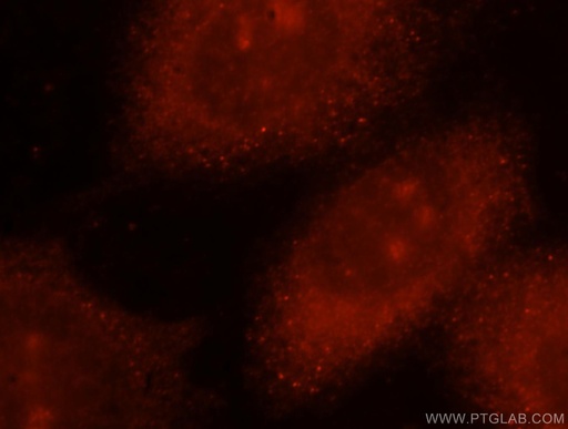 [15548-1-AP-150UL] NADK Polyclonal antibody