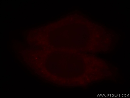 [15549-1-AP-150UL] PRPS1 Polyclonal antibody