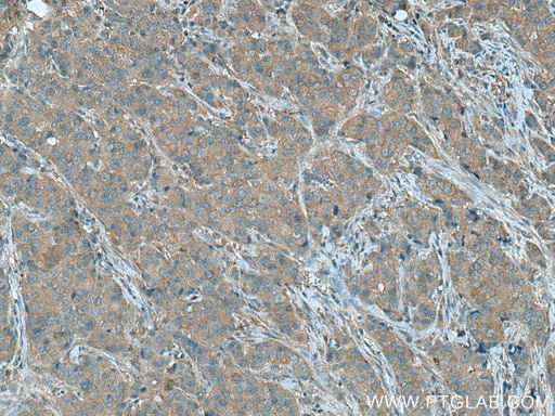 [15550-1-AP-150UL] PGAM2 Polyclonal antibody