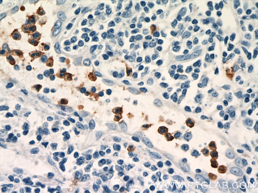 [15551-1-AP-20UL] NOXA2/p67phox Polyclonal antibody