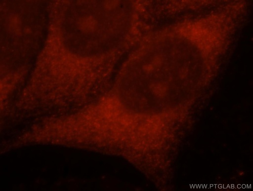 [15552-1-AP-20UL] PNPO Polyclonal antibody