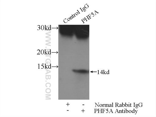 [15554-1-AP-150UL] PHF5A Polyclonal antibody