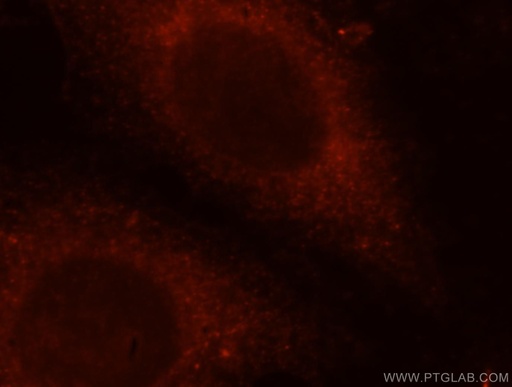 [15555-1-AP-20UL] TRAPPC3 Polyclonal antibody