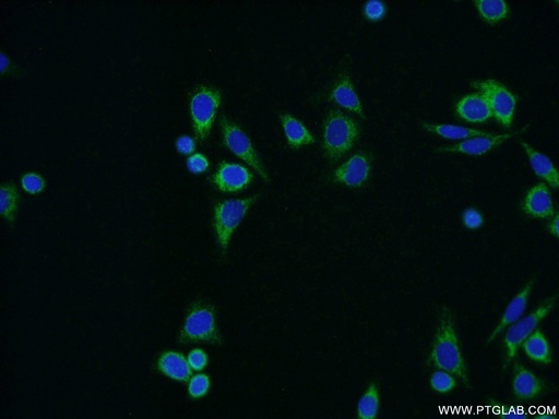 [15560-1-AP-150UL] ALDH1B1 Polyclonal antibody