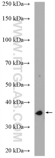 [15563-1-AP-20UL] DIMT1L Polyclonal antibody