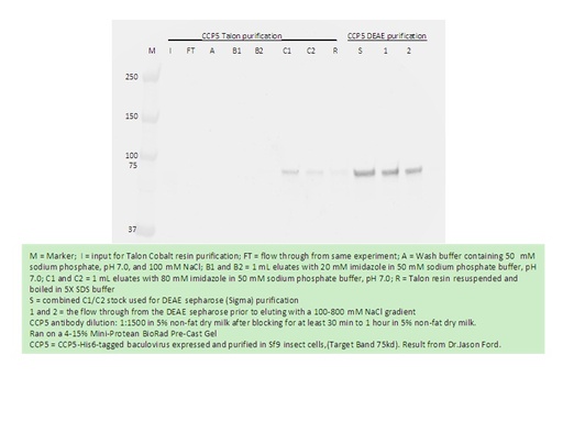 [15569-1-AP-20UL] AGBL5/CCP5 Polyclonal antibody