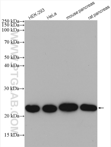 [15572-1-AP-150UL] NDUFB9 Polyclonal antibody