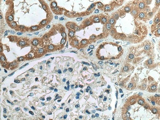 [15573-1-AP-150UL] NDUFC2 Polyclonal antibody