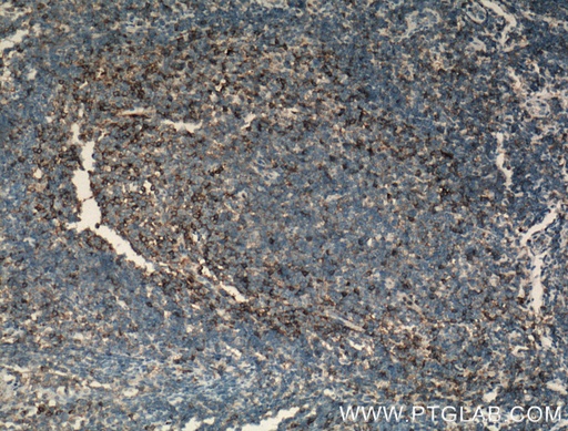 [15574-1-AP-20UL] CD11a/Integrin Alpha L Polyclonal antibody