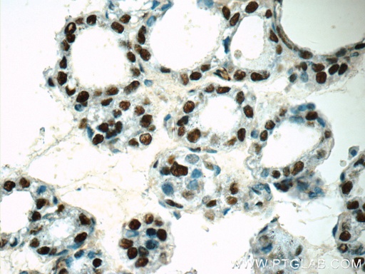 [15575-1-AP-150UL] GMCL1 Polyclonal antibody