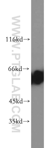 [15579-1-AP-150UL] CBX2 Polyclonal antibody