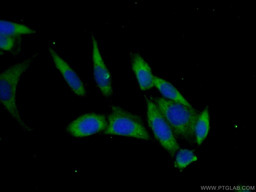 [15583-1-AP-20UL] PAIP2 Polyclonal antibody