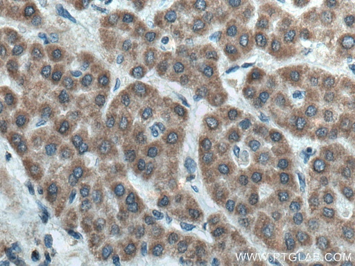 [15584-1-AP-20UL] FDXR Polyclonal antibody