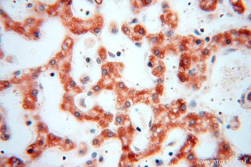 [15589-1-AP-150UL] NDUFB10 Polyclonal antibody