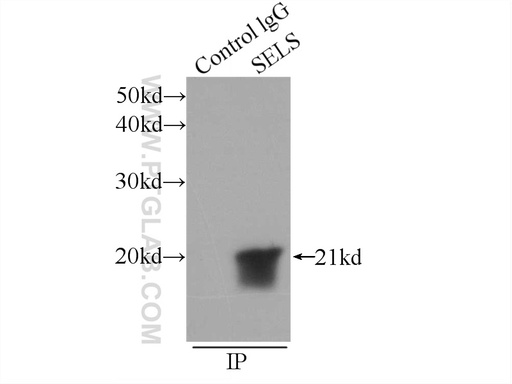 [15591-1-AP-20UL] SELS Polyclonal antibody