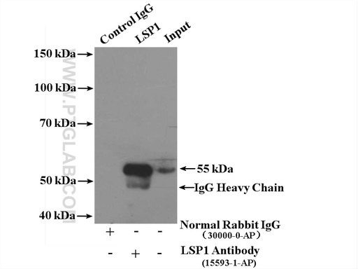 [15593-1-AP-150UL] LSP1 Polyclonal antibody