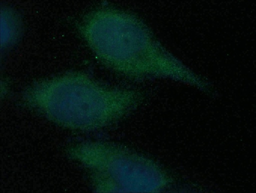 [15594-1-AP-150UL] CDCA3 Polyclonal antibody
