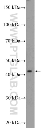 [15595-1-AP-150UL] SSBP4 Polyclonal antibody