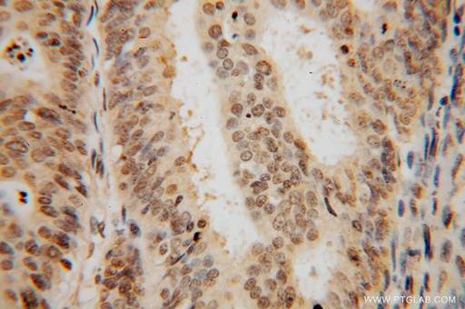 [15596-1-AP-20UL] SF3A2 Polyclonal antibody