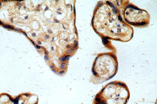 [15598-1-AP-20UL] REXO2 Polyclonal antibody