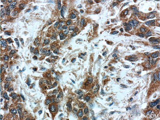 [15601-1-AP-150UL] PSMG3 Polyclonal antibody