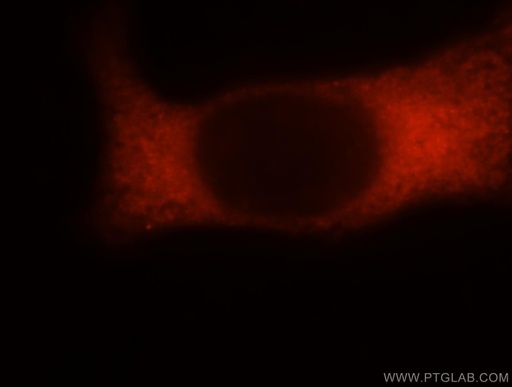 [15603-1-AP-150UL] RPS16 Polyclonal antibody
