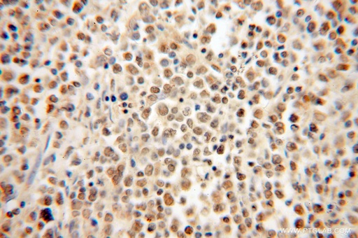 [15605-1-AP-150UL] HMGB2 Polyclonal antibody
