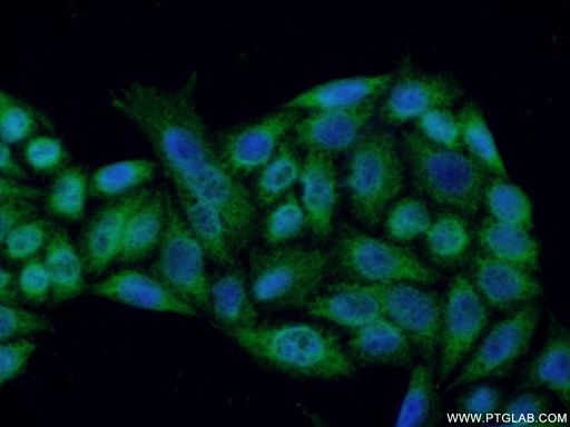 [15606-1-AP-150UL] RNASEH1 Polyclonal antibody