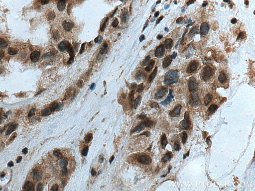 [15608-1-AP-150UL] VRK3 Polyclonal antibody