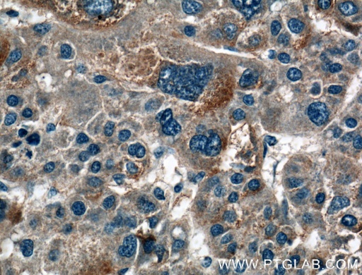 [15609-1-AP-20UL] HAS3 Polyclonal antibody